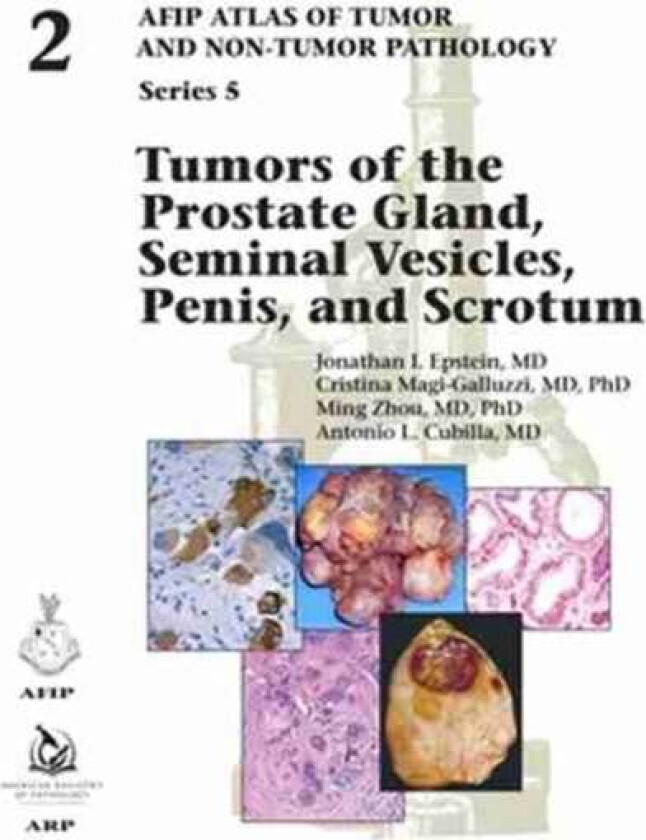 Bilde av Tumors of the Prostate Gland, Seminal Vesicles, Penis, and Scrotum av Jonathan I. Epstein, Cristina Magi-Galluzzi, Ming Zhou, Antonio L. Cubilla