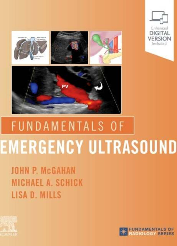 Fundamentals of Emergency Ultrasound av John P. (Department of Radiology University of California Davis Health System Sacramento California) McGahan,