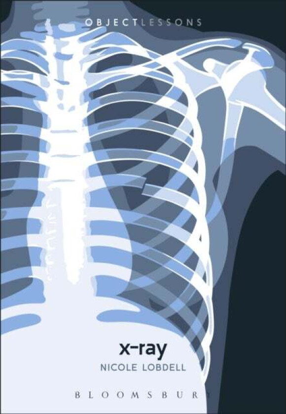 X-ray av Dr. Nicole (Assistant Professor of English Northwestern State University USA) Lobdell