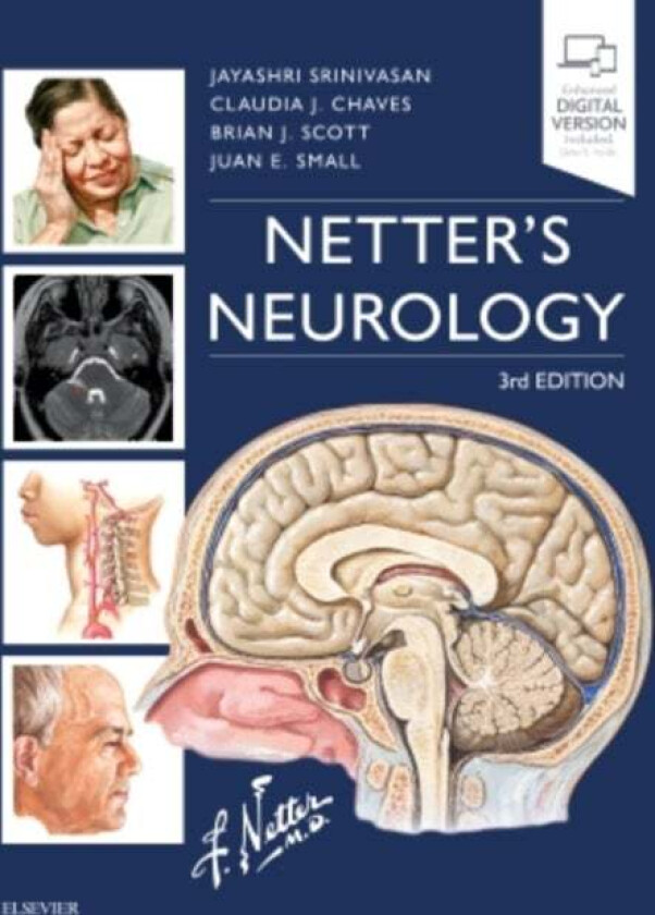 Netter's Neurology