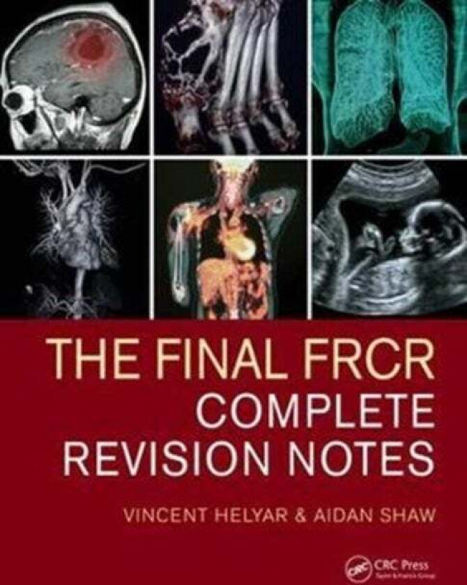 The Final FRCR av Vincent (HHFT NHS UK) Helyar, Aidan (MTW NHS Trust UK) Shaw