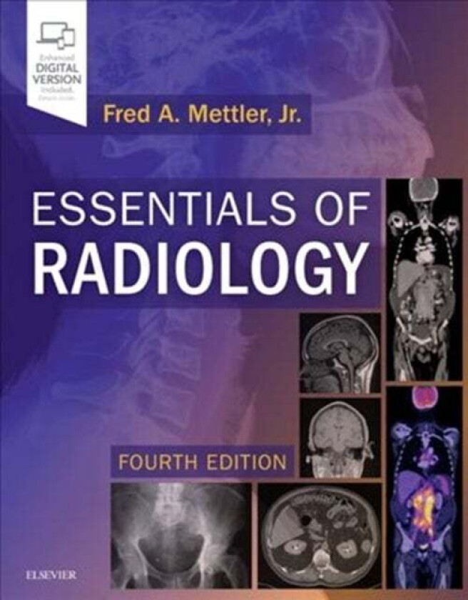 Essentials of Radiology av Fred A. Jr. Mettler