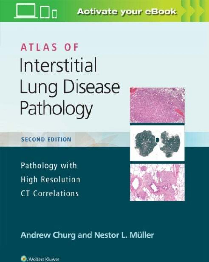 Atlas of Interstitial Lung Disease Pathology av Andrew Churg, Nestor L. Muller