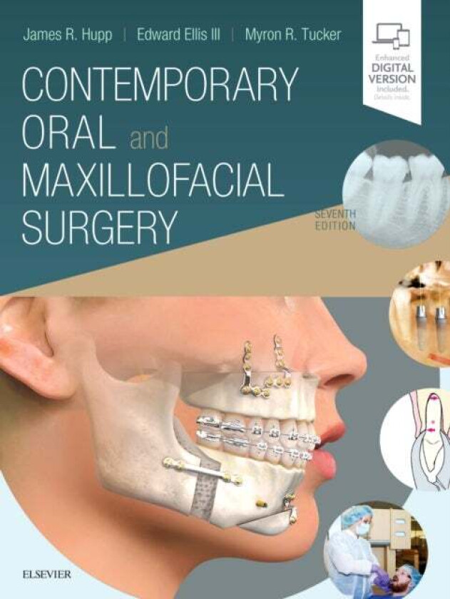 Contemporary Oral and Maxillofacial Surgery av James R. Hupp, Myron R. Tucker, Edward I Ellis