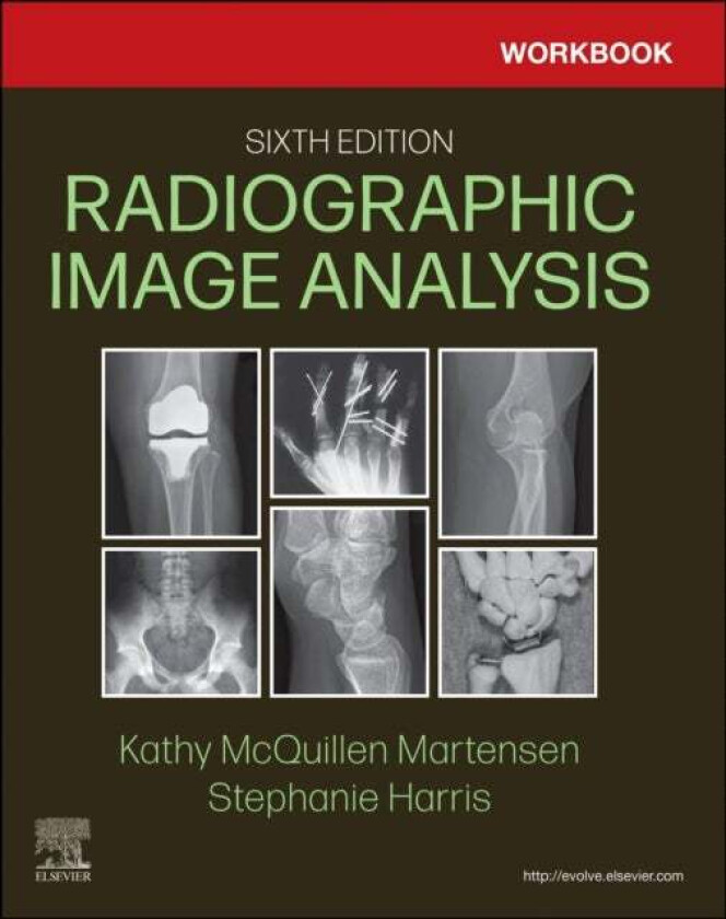 Workbook for Radiographic Image Analysis av Kathy MA RT(R) (Director of Radiologic Technology Education Department of Radiology The University of Iowa