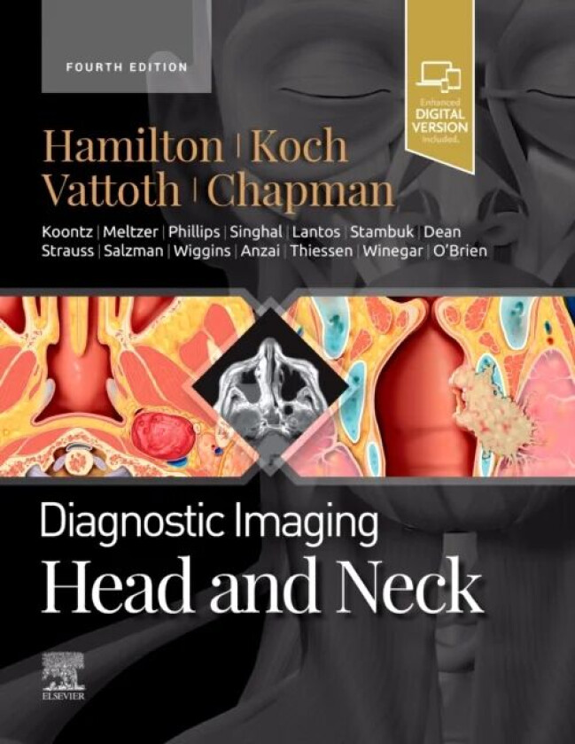 Bilde av Diagnostic Imaging: Head and Neck av Bernadette L. (Associate Director of Radiology Cincinnati Children's Hospital Medical Center Professor of Ra