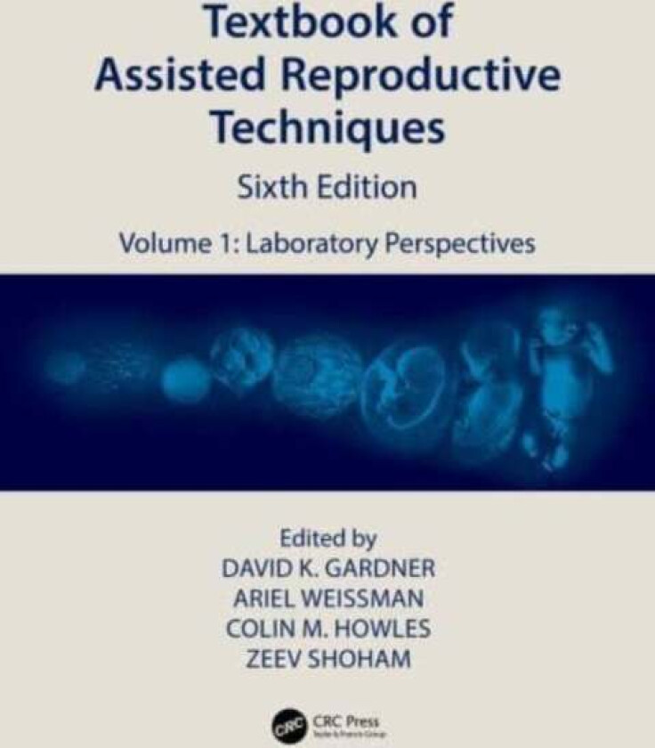 Textbook of Assisted Reproductive Techniques