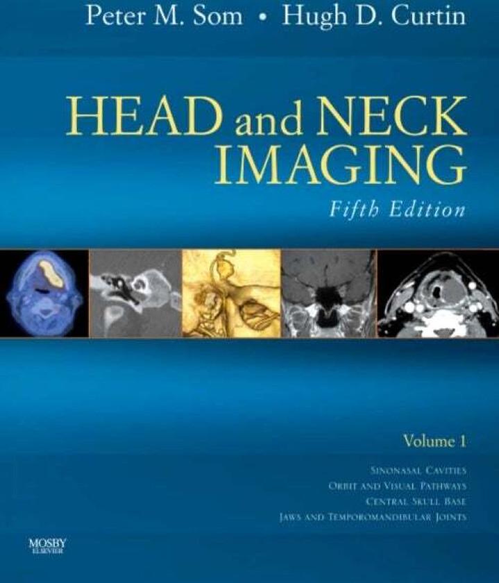 Head and Neck Imaging - 2 Volume Set av Peter M. (Professor of Radiology Otolaryngology and Radiation Oncology Som, Mount Sinai Medical Center New Yor