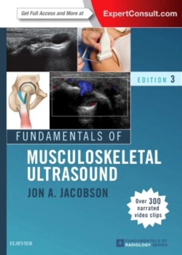 Bilde av Fundamentals of Musculoskeletal Ultrasound av Jon A. (Associate Professor of Radiology Jacobson, Division of Musculoskeletal Radiology University of M