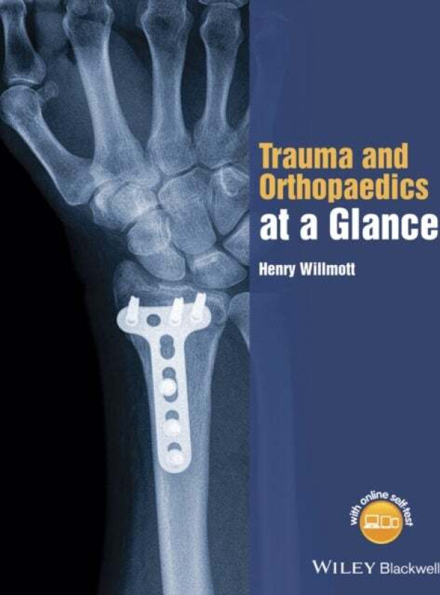 Trauma and Orthopaedics at a Glance av Henry Willmott