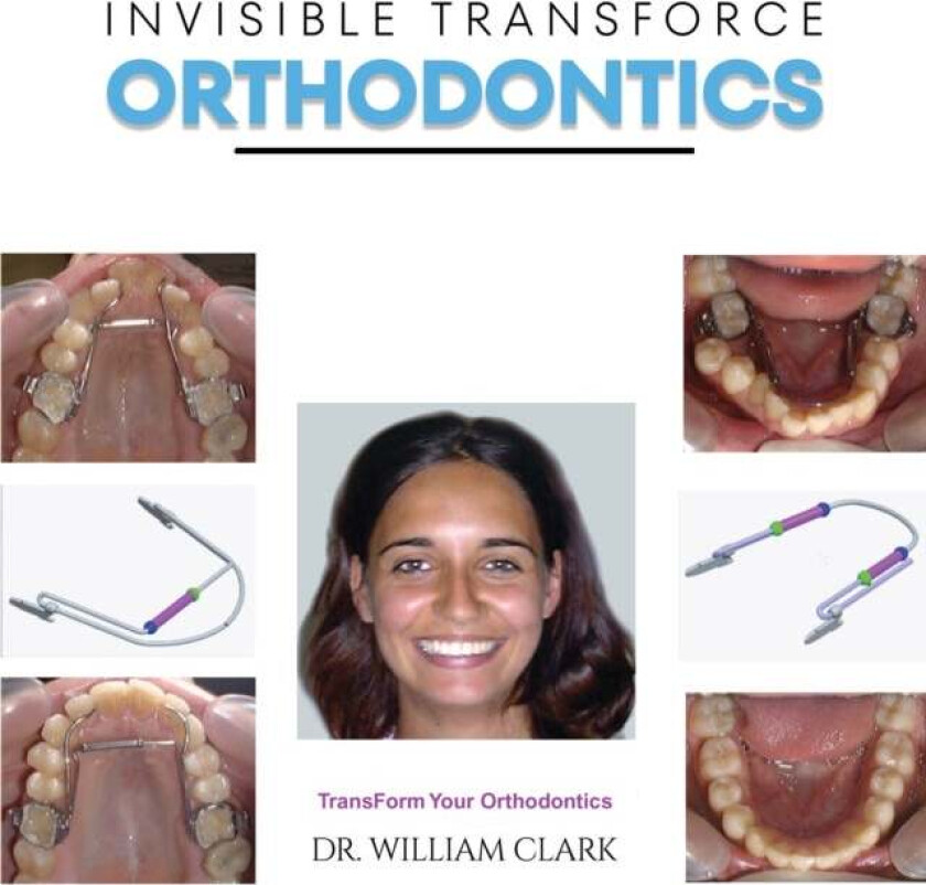 Invisible TransForce Orthodontics av Dr. William Clark