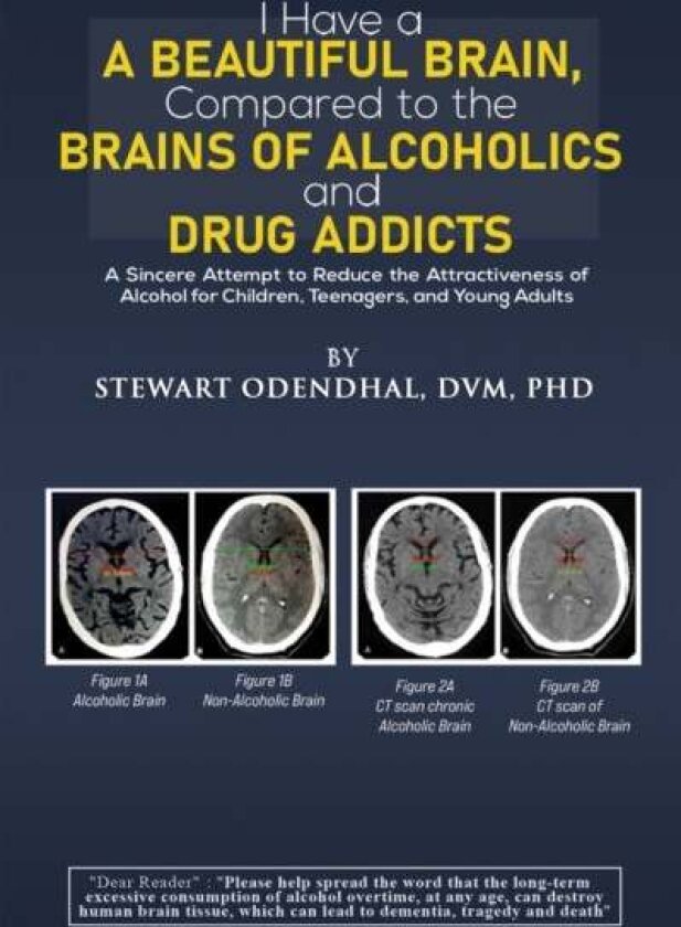 I Have a Beautiful Brain, Compared to the Brains of Alcoholics and Drug Addicts av DVM PhD Stewart Odendhal