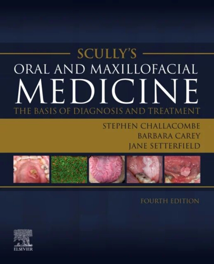 Scully's Oral and Maxillofacial Medicine: The Basis of Diagnosis and Treatment av Stephen J. (Martin Rushton Professor of Oral Medicine Centre fo
