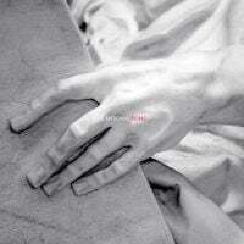 The National - Rome (While Vinyl)