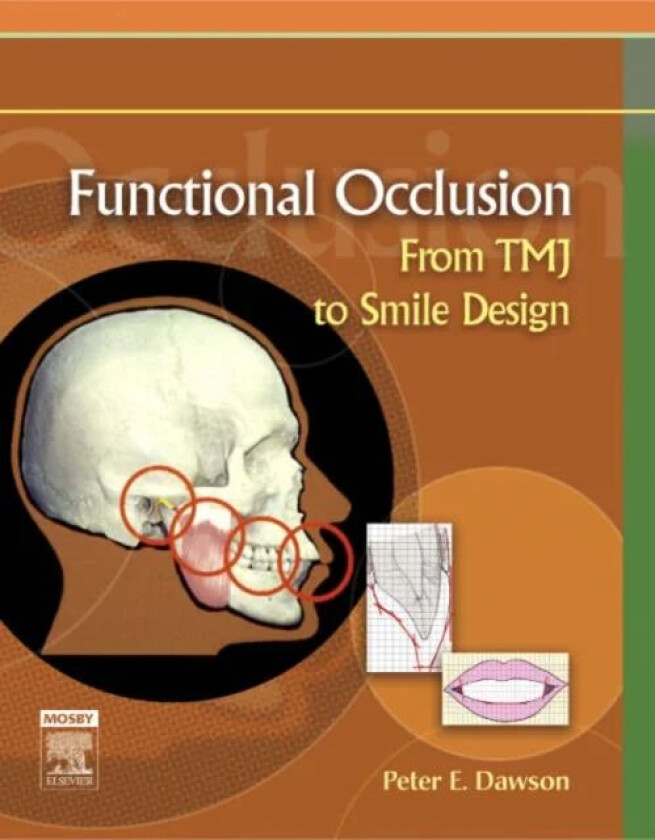 Bilde av Functional Occlusion av Peter E. Dawson