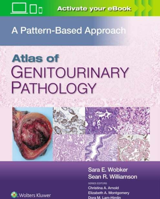 Bilde av Atlas of Genitourinary Pathology av Sara E. MD MPH Wobker, Sean R. MD FASCP Williamson