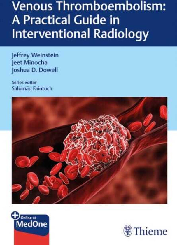 Venous Thromboembolism A Practical Guide in Interventional Radiology