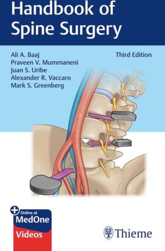 Handbook of Spine Surgery