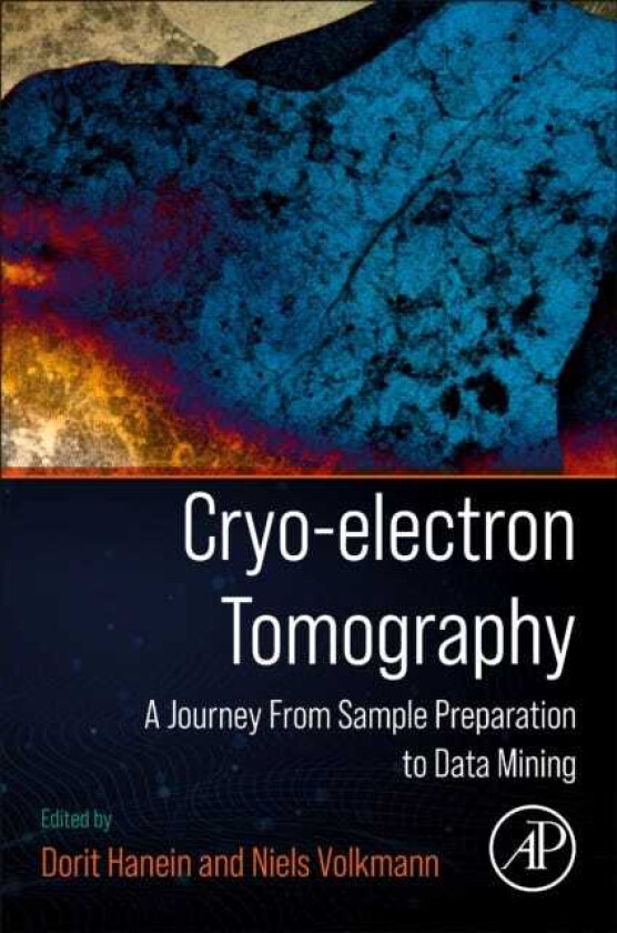 Cryoelectron Tomography  A Journey from Sample Preparation to Data Mining