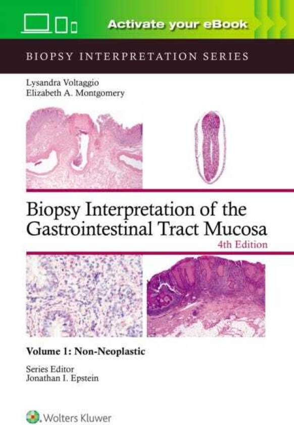 Biopsy Interpretation of the Gastrointestinal Tract Mucosa Volume 1 NonNeoplastic: Print + eBook with Multimedia