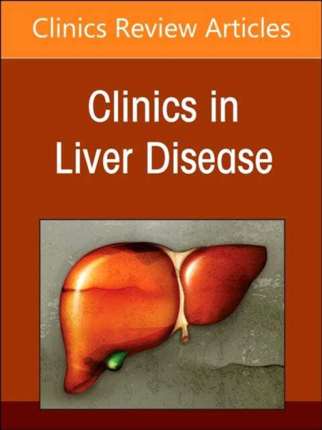 AlcoholAssociated Liver Disease, An Issue of Clinics in Liver Disease