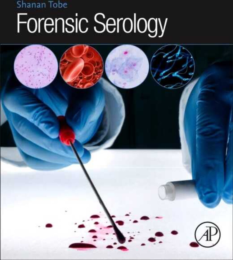 Forensic Serology