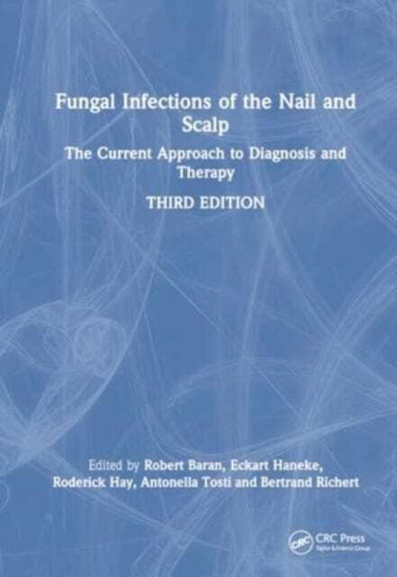 Fungal Infections of the Nail and Scalp The Current Approach to Diagnosis and Therapy