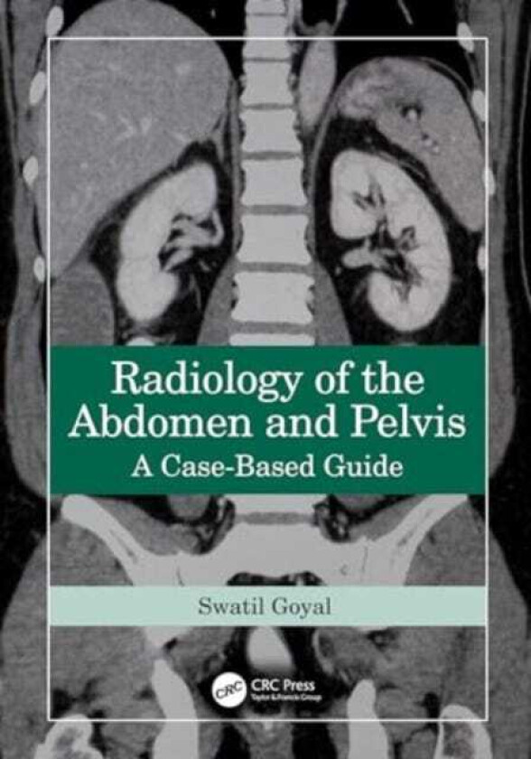Radiology of the Abdomen and Pelvis A CaseBased Guide