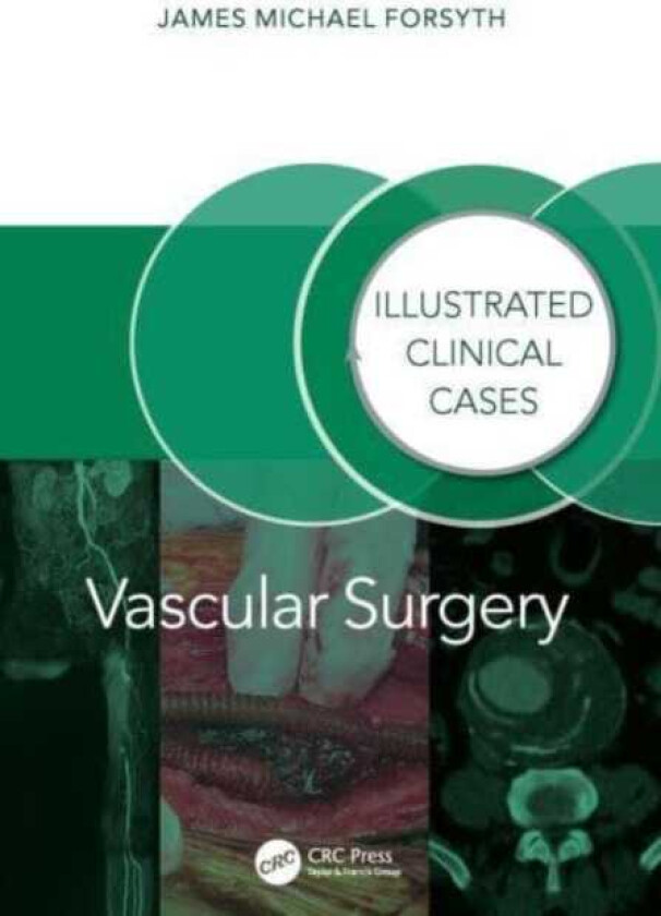 Vascular Surgery: Illustrated Clinical Cases