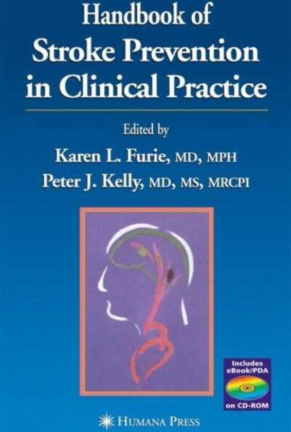 Handbook of Stroke Prevention in Clinical Practice
