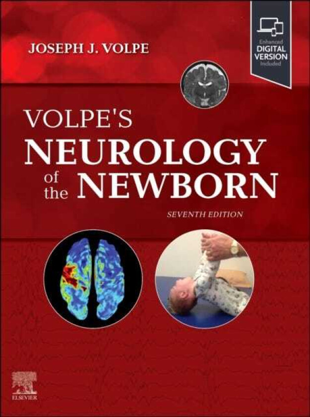 Bilde av Volpe's Neurology of the Newborn