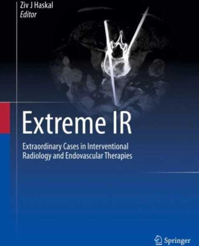 Extreme IR  Extraordinary Cases in Interventional Radiology and Endovascular Therapies