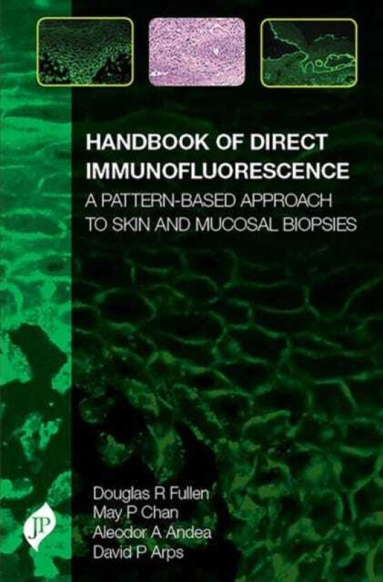 Handbook of Direct Immunofluorescence A PatternBased Approach to Skin and Mucosal Biopsies