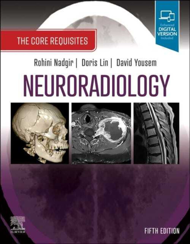 Neuroradiology  The Core Requisites