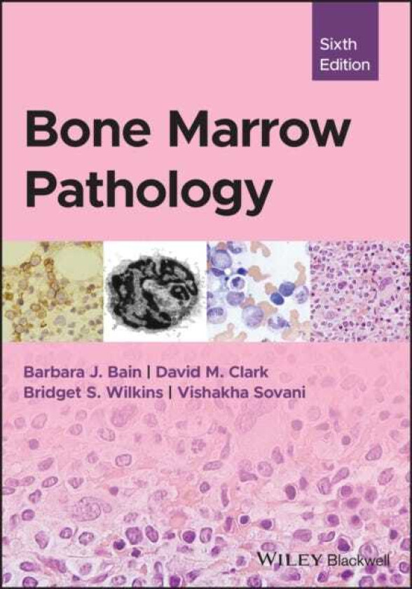 Bone Marrow Pathology