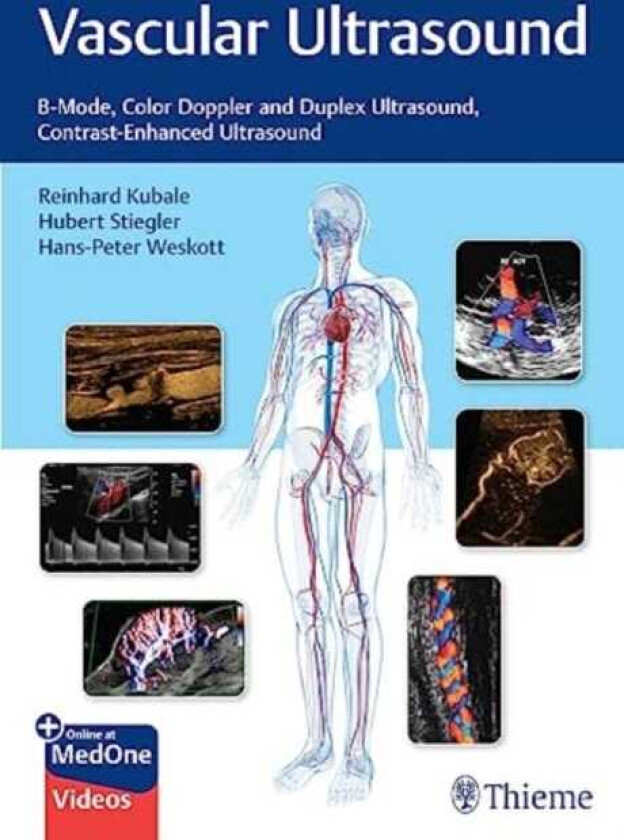 Vascular Ultrasound