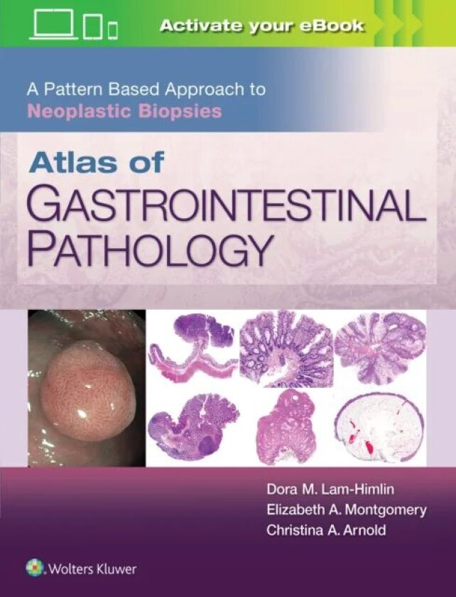 Atlas of Gastrointestinal Pathology: A Pattern Based Approach to Neoplastic Biopsies av Christina Arnold, Dora Lam-Himlin, Elizabeth A. Montgomery