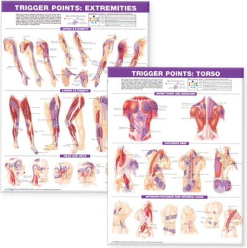 Trigger Point Chart Set: Torso & Extremities Lam