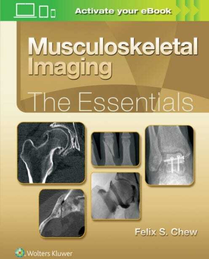Musculoskeletal Imaging: The Essentials