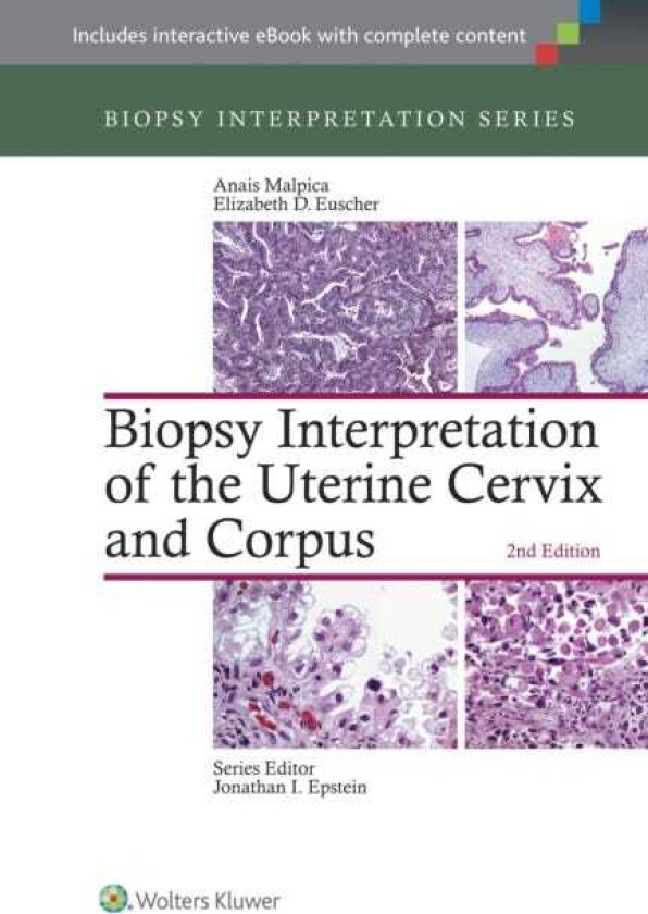 Biopsy Interpretation of the Uterine Cervix and Corpus