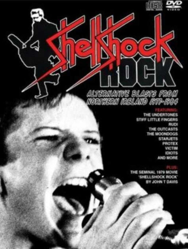 Diverse Artister Shellshock Rockalternative Blasts N. Ireland 19771984 (3cd+DVD) CD