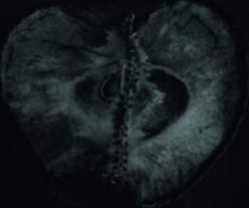 Sádon & Treha Sektori, Sádon, Treha Sektori Symphony Of Dying LP/Vinyl