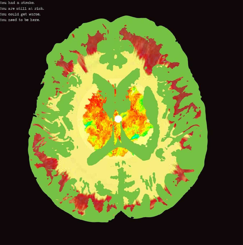 The Minus 5 Stroke Manor LP/Vinyl