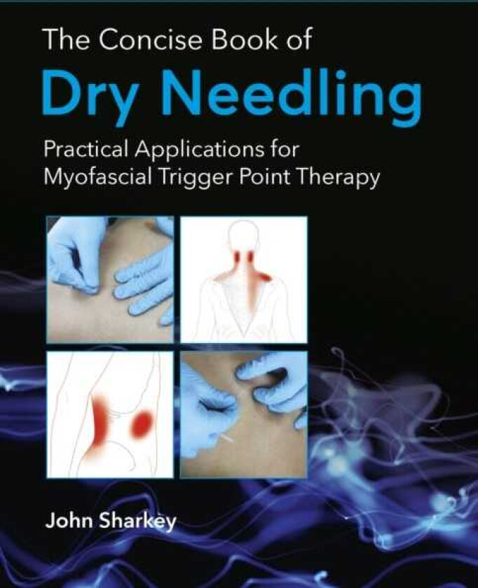 The Concise Book of Dry Needling Practical Applications for Myofascial Trigger Point Therapy