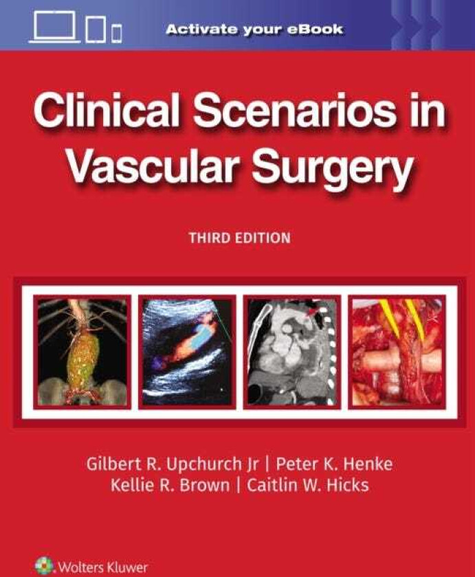Clinical Scenarios in Vascular Surgery