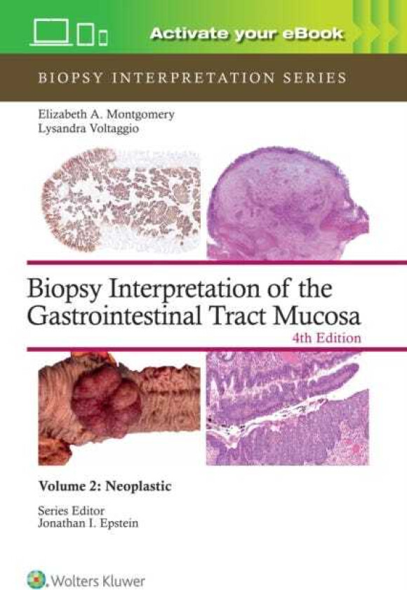 Biopsy Interpretation of the Gastrointestinal Tract Mucosa Volume 2 Neoplastic: Print + eBook with Multimedia