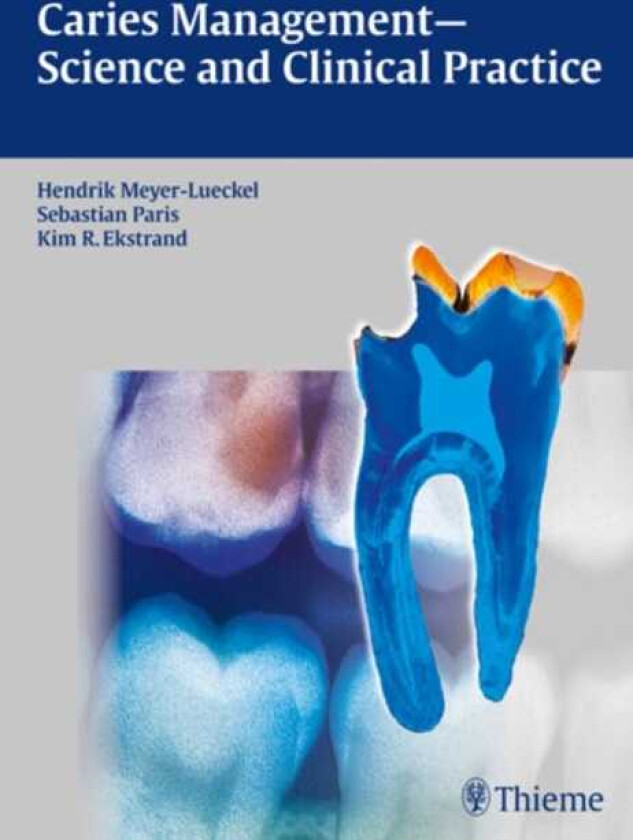 Caries Management Science and Clinical Practice