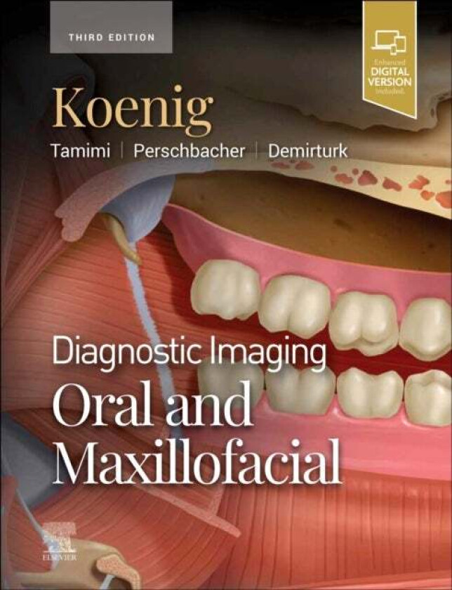 Bilde av Diagnostic Imaging: Oral and Maxillofacial av Lisa J. (Associate Dean for Academic Affairs Professor Oral Medicine and Oral Radiology Marquette Univer