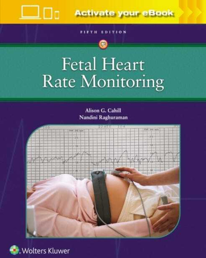 Fetal Heart Rate Monitoring