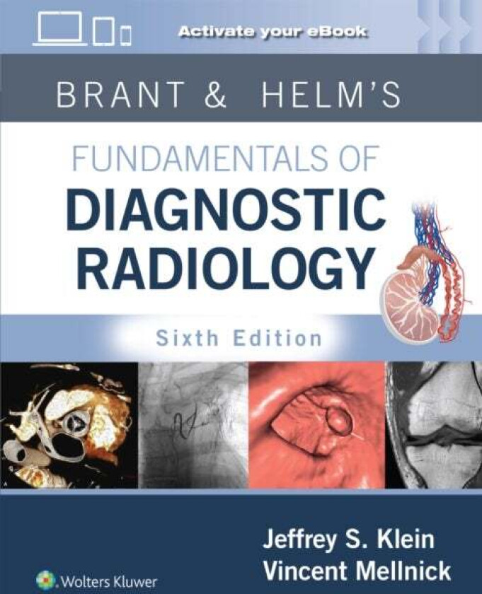 Bilde av Brant & Helm's Fundamentals of Diagnostic Radiology: Print + eBook with Multimedia av Jeffrey MD FACR Klein, Vincent Mellnick